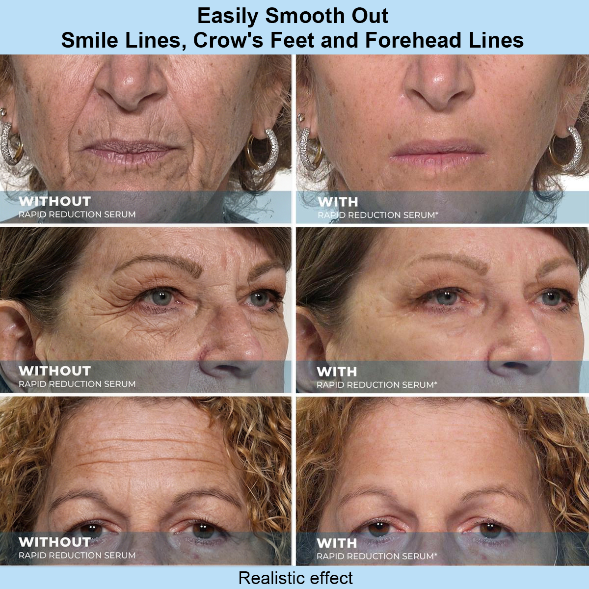 Mirobeau™ Instant Face Temporary Tightener – Instant visible results in 30 seconds