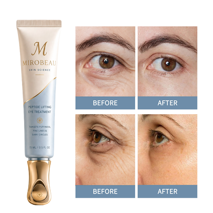Mirobeau™ Instant Face Temporary Tightener – Instant visible results in 30 seconds