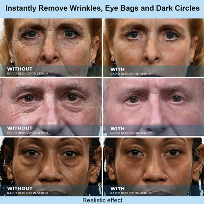Mirobeau™ Instant Face Temporary Tightener – Instant visible results in 30 seconds